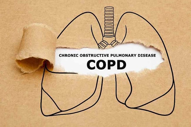 home remedies for COPD