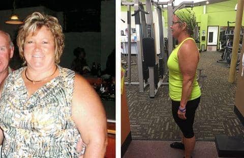 before-after