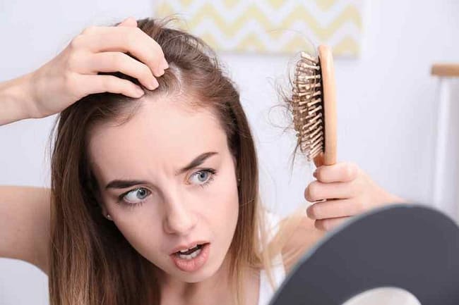 home remedies for female pattern baldness
