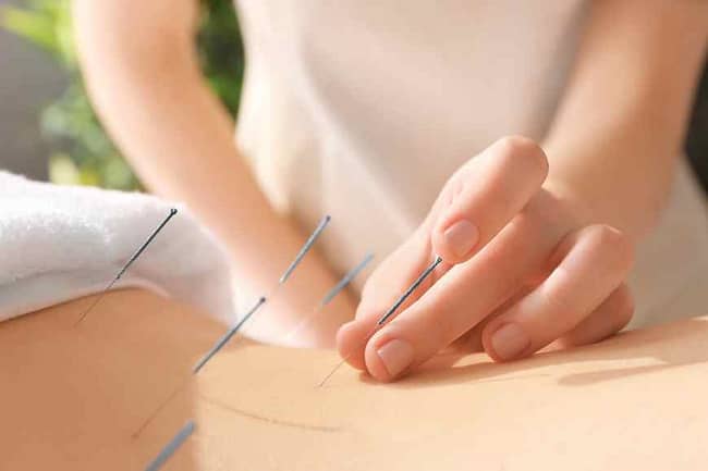 Acupuncture use to treat muscle pain as an home remedies